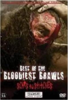 TNA Wrestling: Best of the Bloodiest Brawls - Scars and Stitches观看